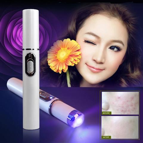 Blue Light Therapy Acne Laser Pen Soft Scar Wrinkle Removal - Infinite Goods Shop