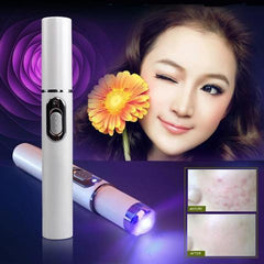 Blue Light Therapy Acne Laser Pen Soft Scar Wrinkle Removal - Infinite Goods Shop
